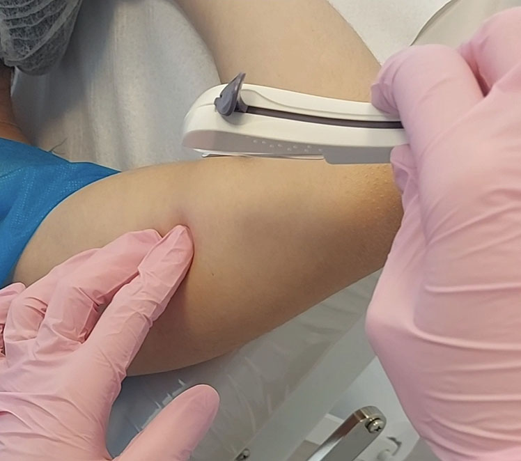 Ginecologista Especialista em Contracepção